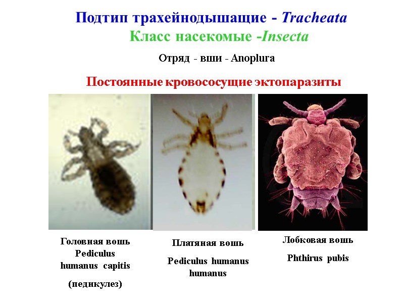 Подтип трахейнодышащие - Tracheata  Класс насекомые -Insecta Отряд - вши - Anoplura Постоянные